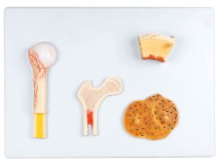 Plate of cross-sections of human bone